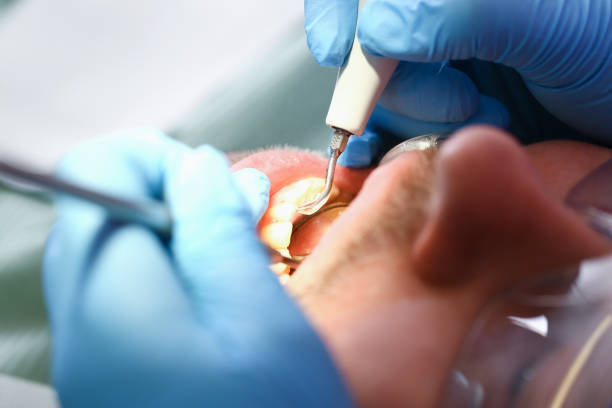 Best Emergency Dentist for Knocked-Out Tooth in Coweta, OK